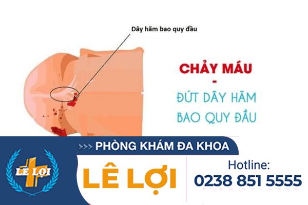 Dut-day-ham-bao-quy-dau (3)